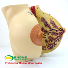 SELL 12459 Female Breast Section Anatomical Model in Period 2 Parts Anatomy